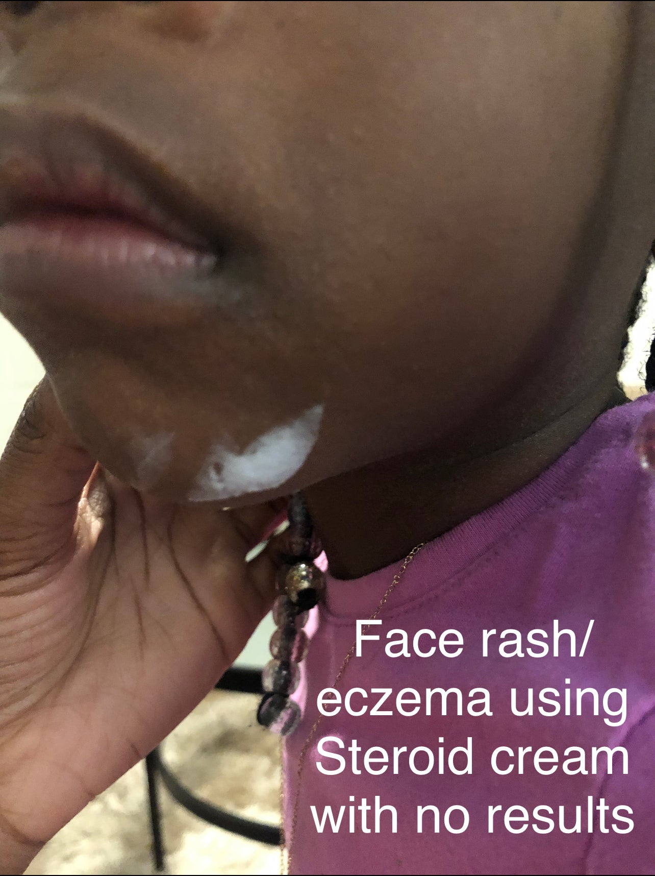 Baby Kenneth’s Whipped Shea Butter