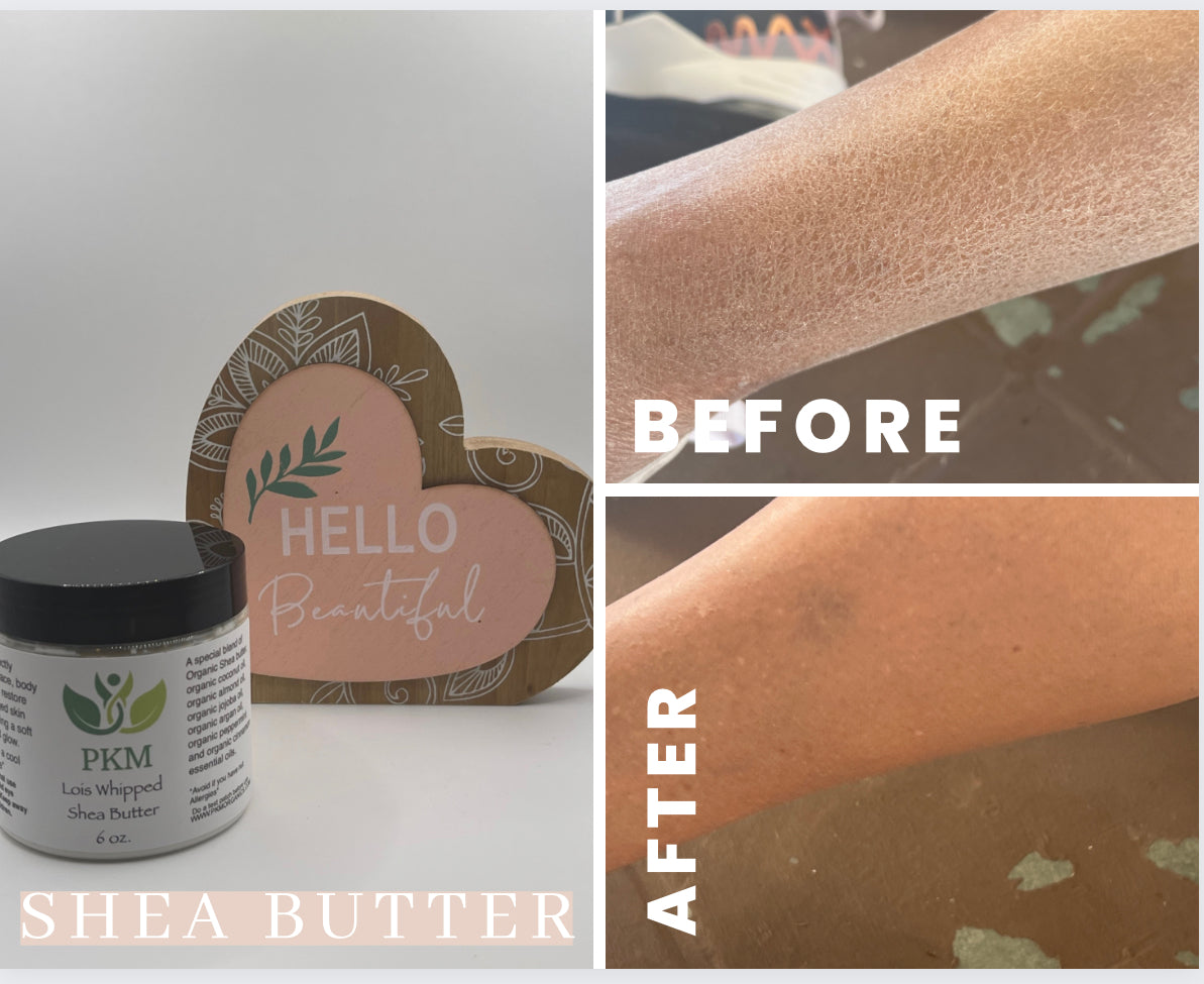 Lois’ Whipped Shea Butter